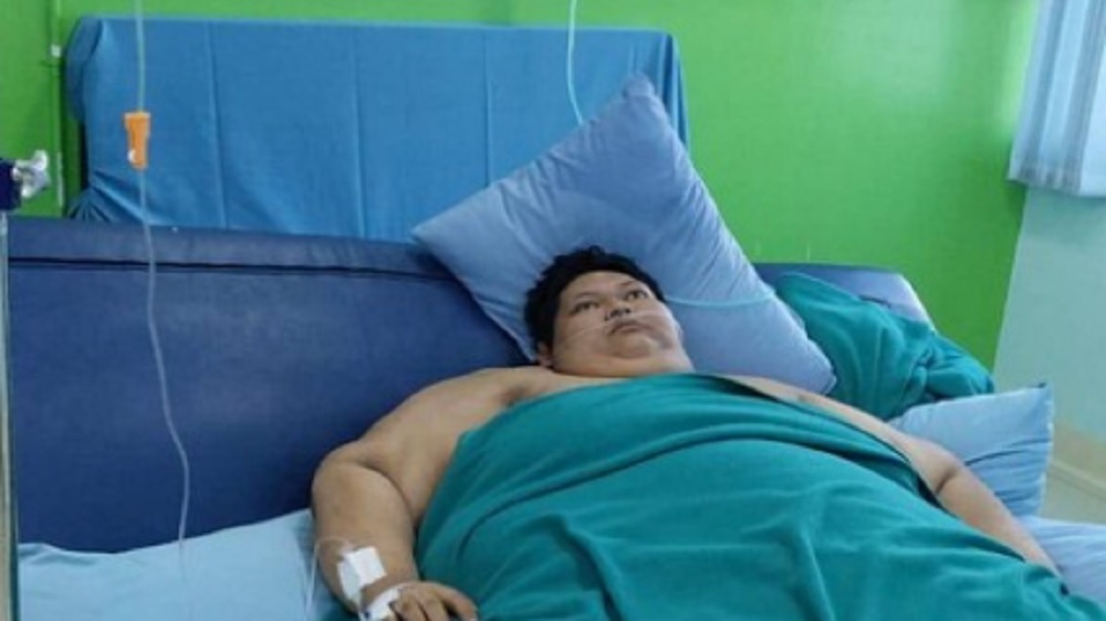 Pemuda dengan Obesitas Berbobot 300 Kilogram Meninggal Dunia Setelah Perjuangan Panjang