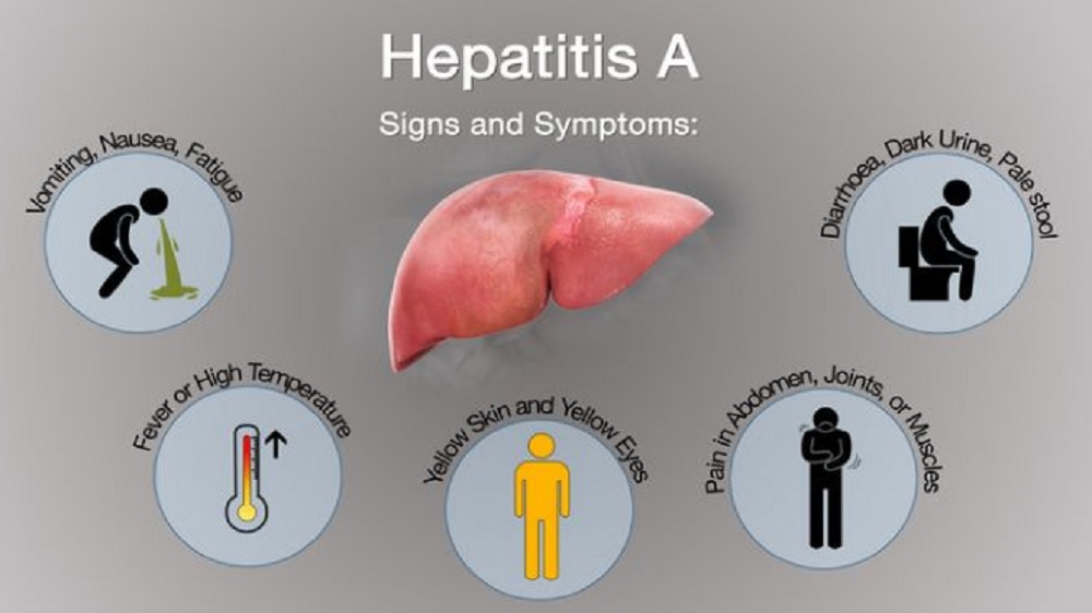 Mengenal Hepatitis A, Gejalanya Bisa dari Demam