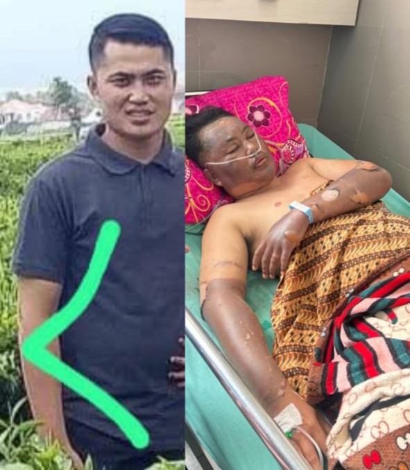 JELANG PERNIKAHAN, SECURITY JAMTOS JADI KORBAN LEDAKAN DAPUR