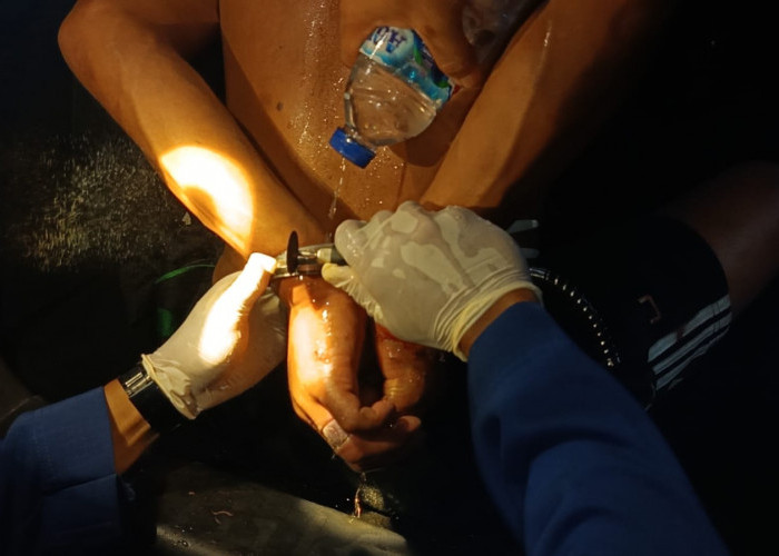 Damkartan Kota Jambi Evakuasi Cincin dan Gelang Titanium dari Pasien ODGJ