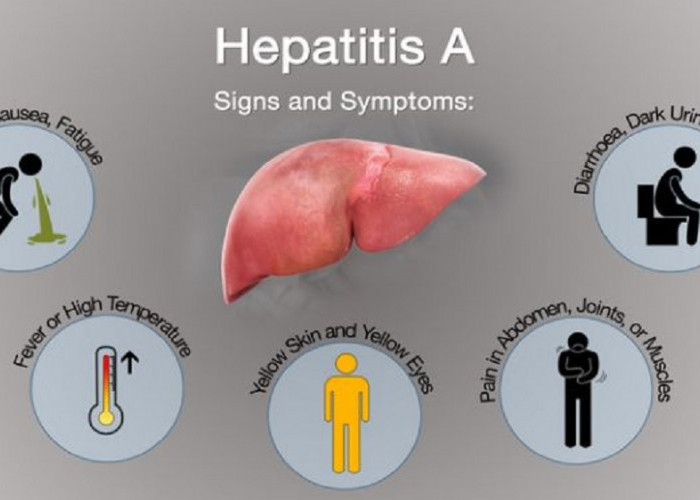 Mengenal Hepatitis A, Gejalanya Bisa dari Demam