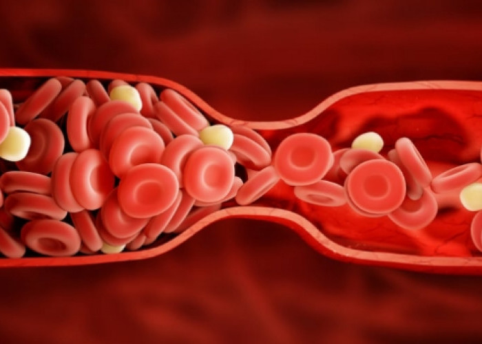 Gangguan Darah yang Perlu Diwaspadai: Gejala dan Pencegahannya