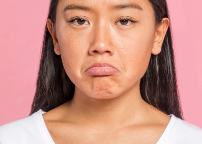 B ERL Very Berry Acne Spot Treatment, Senjata Praktis Lawan Jerawat Membandel!