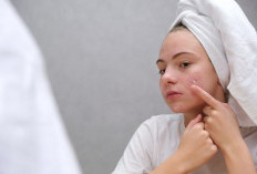 5 Kandungan Skincare yang Efektif Membantu Memudarkan Bekas Jerawat