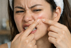 Kulit Kering hingga Jerawatan Saat Puasa, Ini Cara Sederhana Menjaganya Tetap Sehat