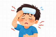 Surat Edaran Kemenkes Ditindaklanjuti, Jambi Tingkatkan Kewaspadaan Campak