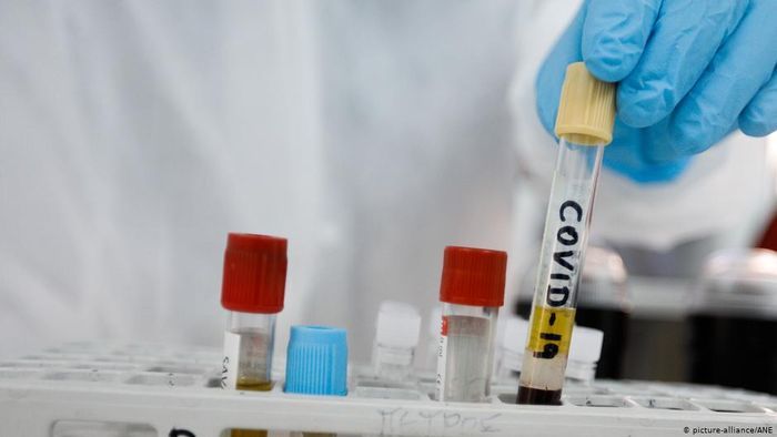 Vaksin Covid-19 Buatan China Siap Dipasarkan Akhir 2020