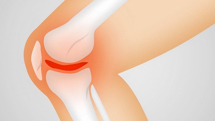 Agar Terhindar dari Masalah Lutut